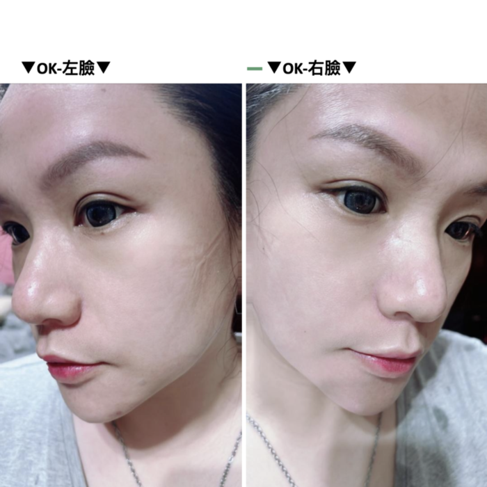 EVOXOME 外泌體精華液使用後照片
