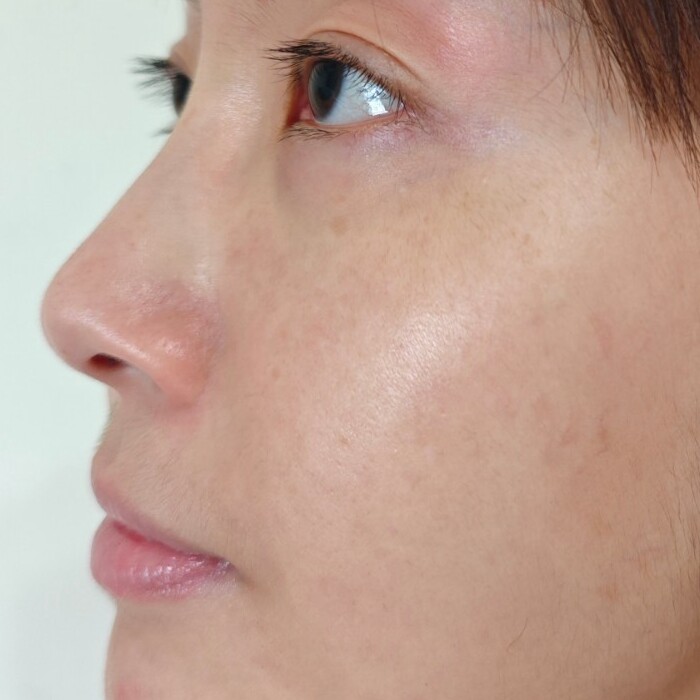 EVOXOME 外泌體精華液使用後照片