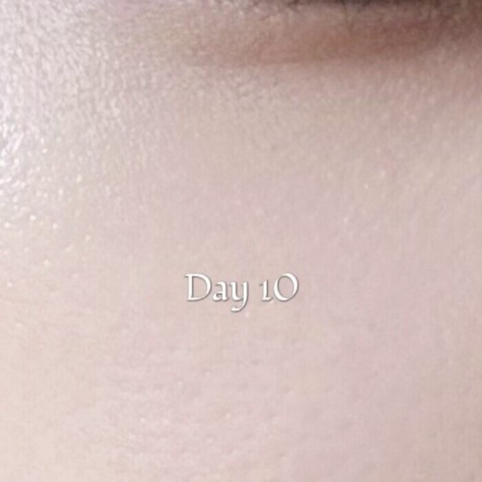 EVOXOME 外泌體精華液使用後照片-Day10