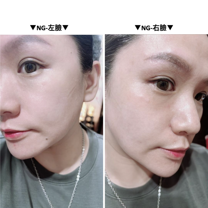 EVOXOME 外泌體精華液使用前照片