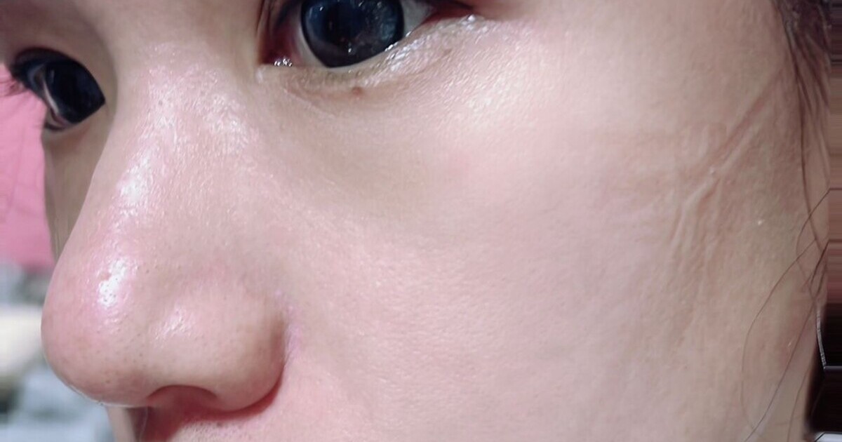 毛孔粗大的救星｜我的外泌體精華實測改善日記