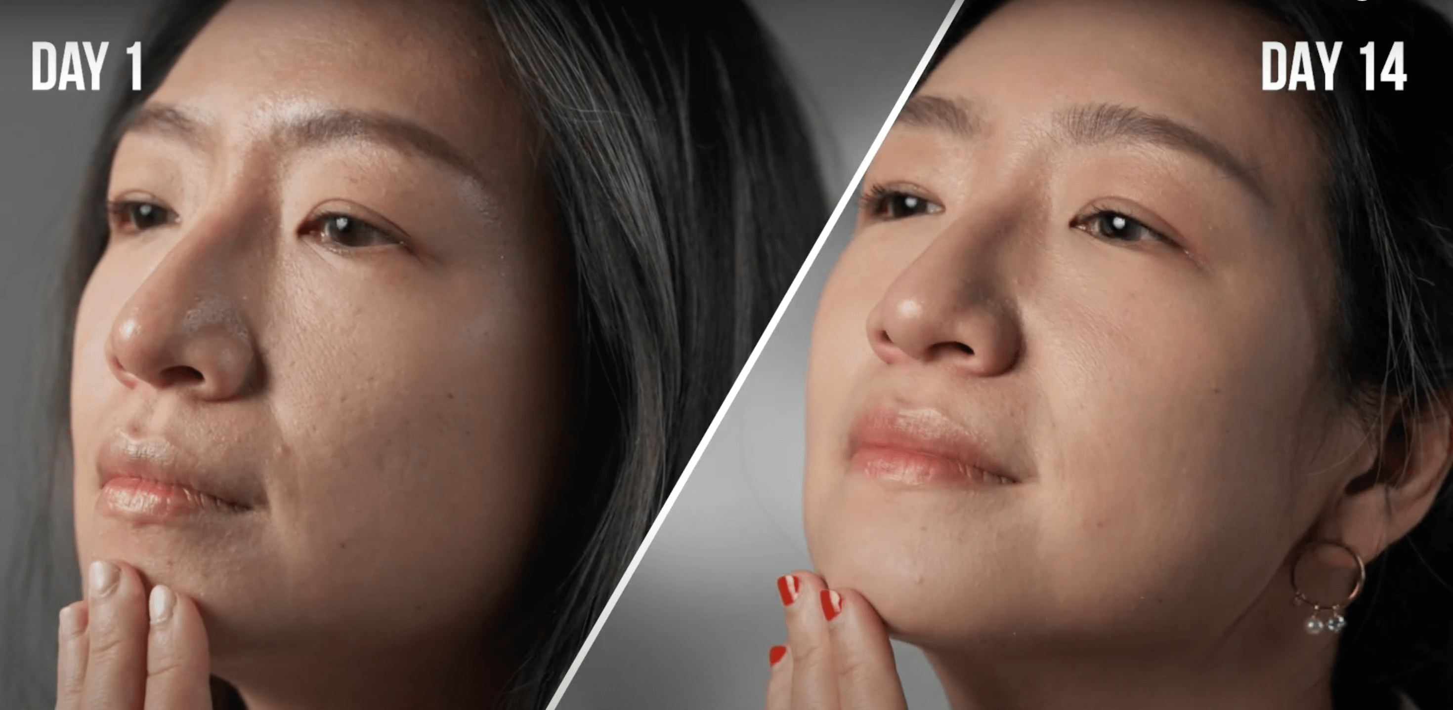 減法保養的14天驚喜蛻變｜二寶媽兼全職工作者Anna真心推薦 