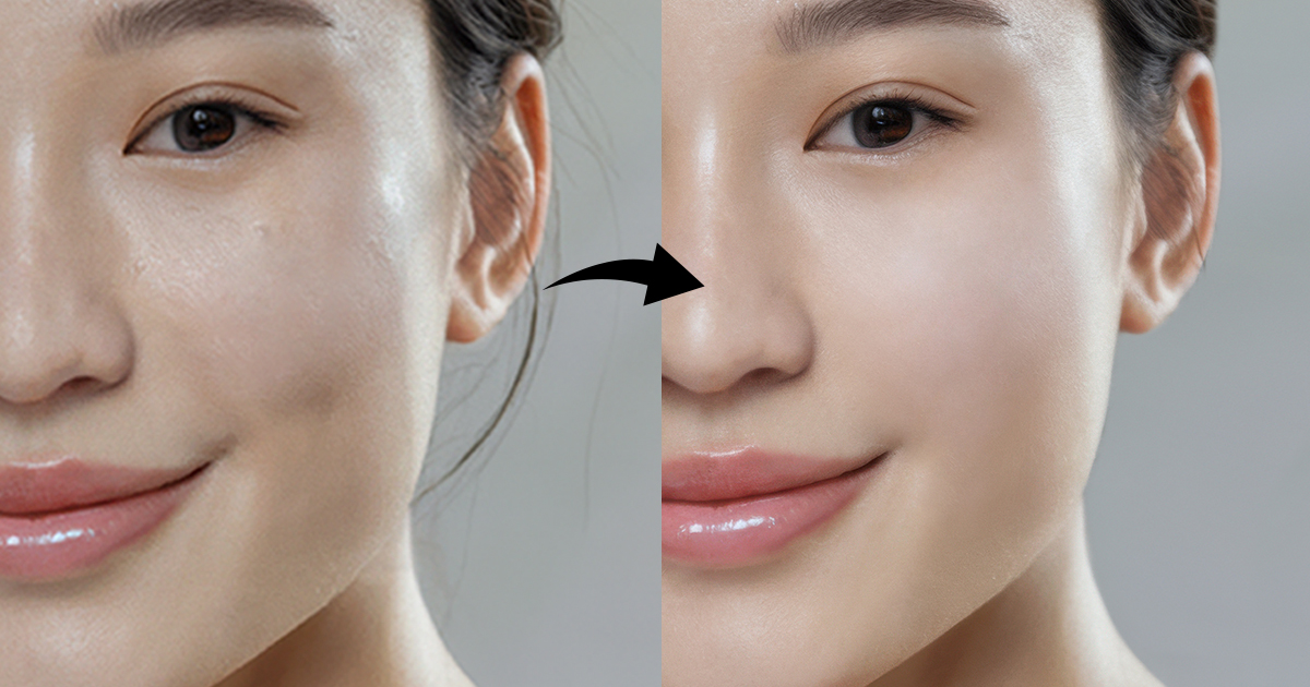 肌膚老化 vs 使用外泌體後改善