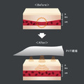 Venex美體機能腰圍-4